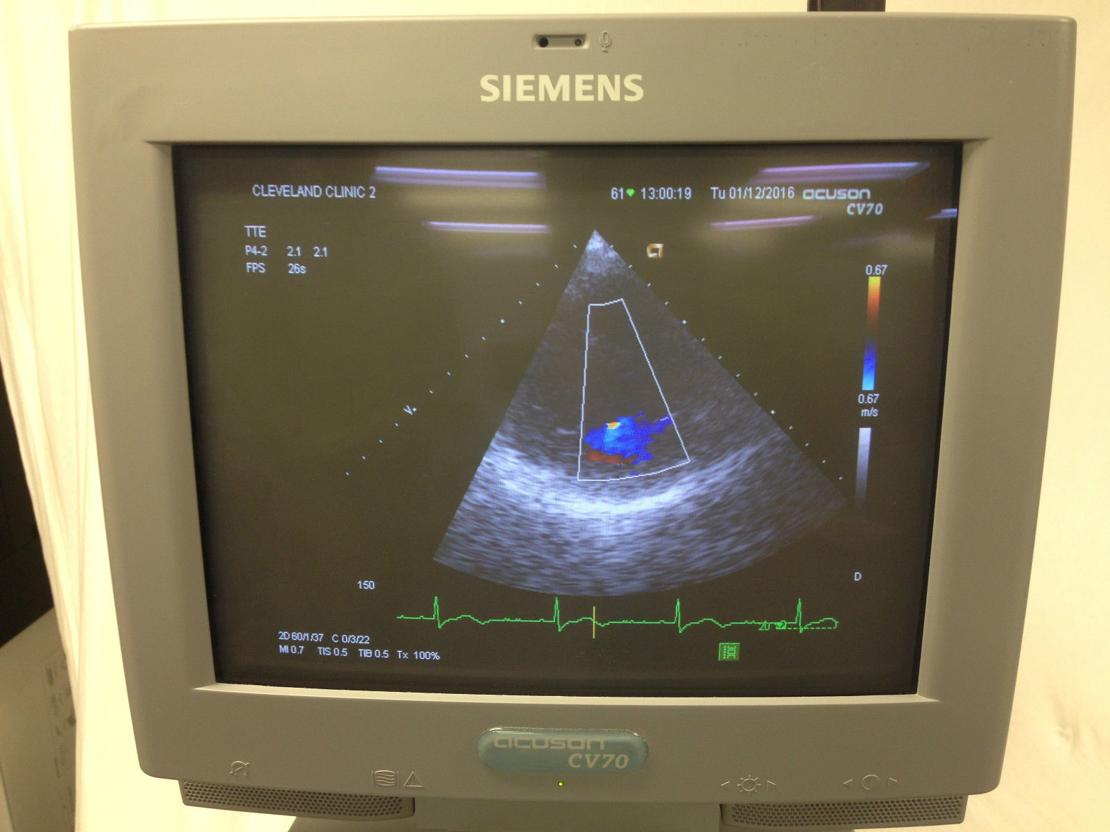 Siemens Acuson CV70 Cardiac Vascular Ultrasound Machine. L10-5 P4-2 Included DIAGNOSTIC ULTRASOUND MACHINES FOR SALE