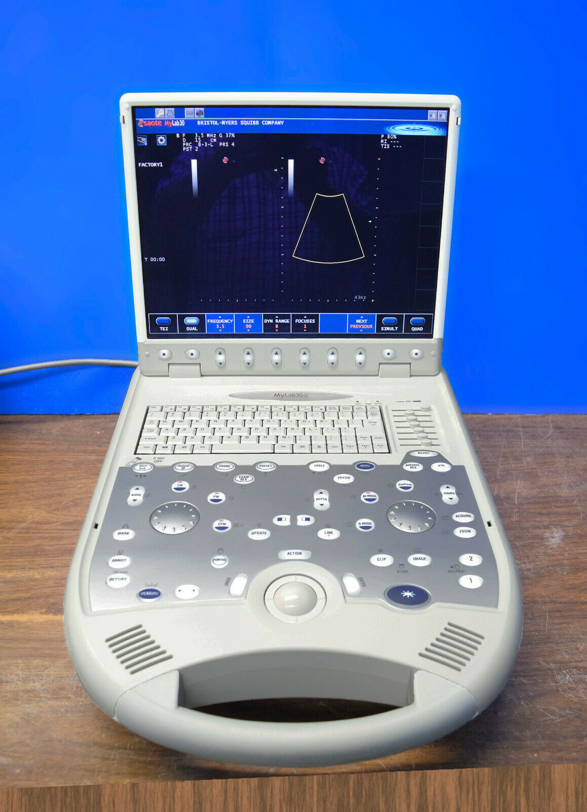 Biosound Esaote MyLab 30CV portable ultrasound machine DIAGNOSTIC ULTRASOUND MACHINES FOR SALE