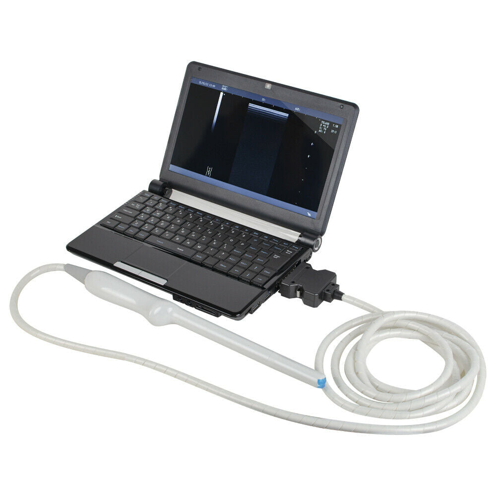 Full Digital Laptop Ultrasound Scanner System Convex Linear Probe DIAGNOSTIC ULTRASOUND MACHINES FOR SALE