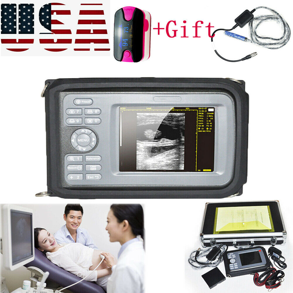 Portable Handheld Ultrasound Scanner Machine Digital+Convex Probe For Human US DIAGNOSTIC ULTRASOUND MACHINES FOR SALE