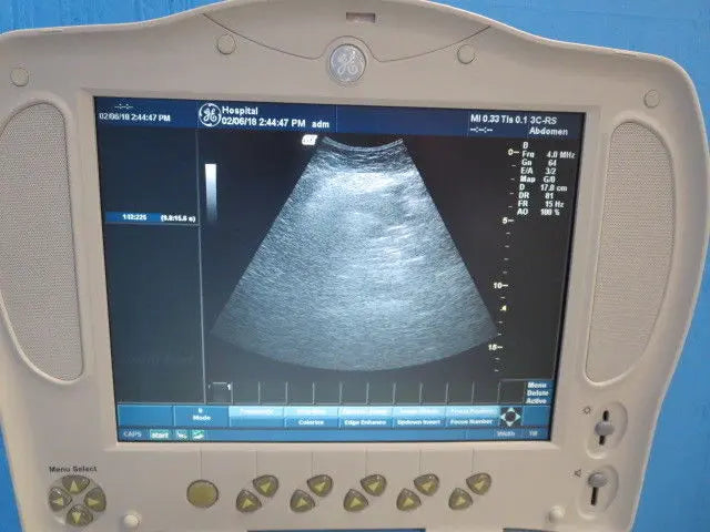 GE Logiq Book XP  3C-RS Ultrasound Probe Transducer  2333880 DIAGNOSTIC ULTRASOUND MACHINES FOR SALE