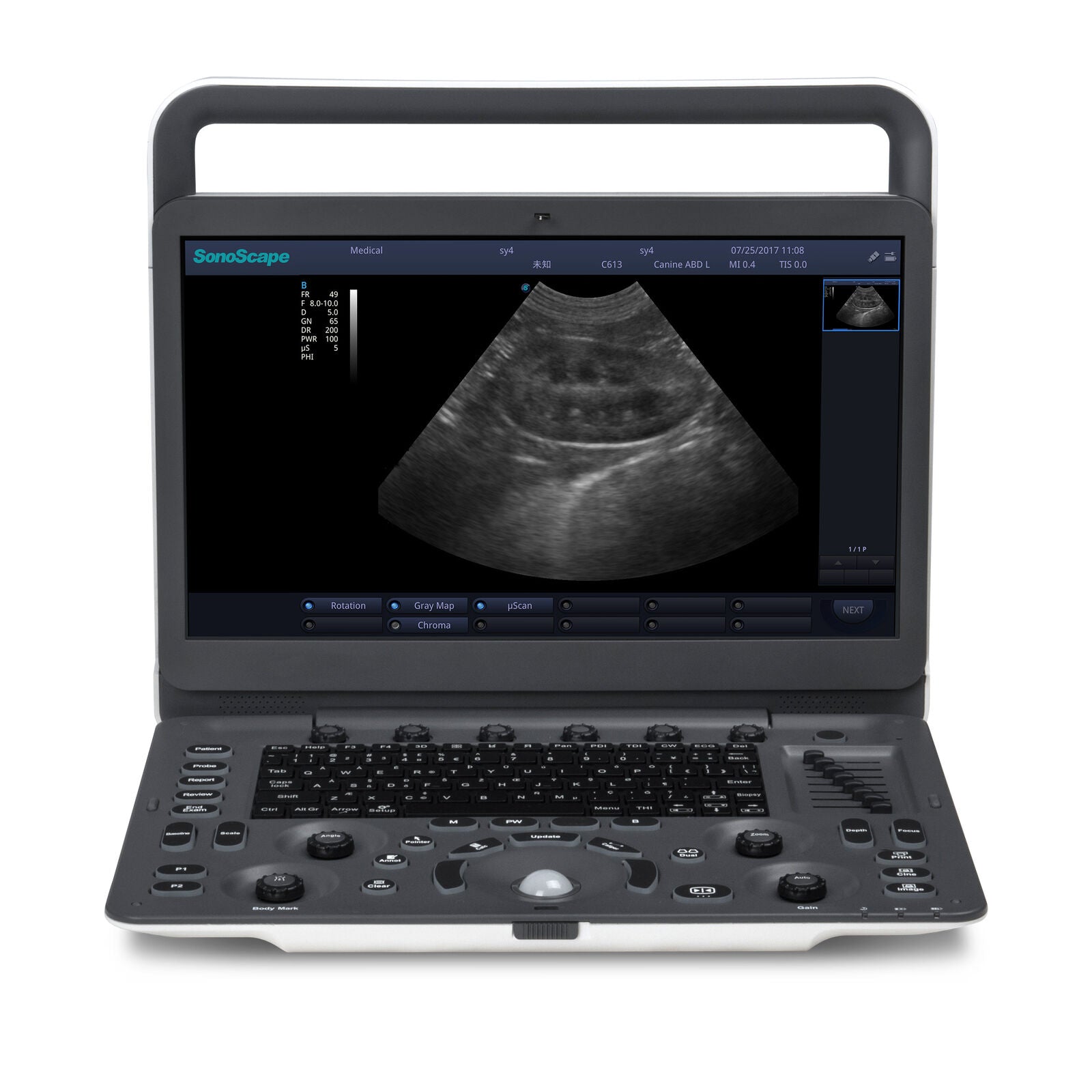 SonoScape A6V Expert (E1V) Veterinary Ultrasound & large animals rectal Probe DIAGNOSTIC ULTRASOUND MACHINES FOR SALE