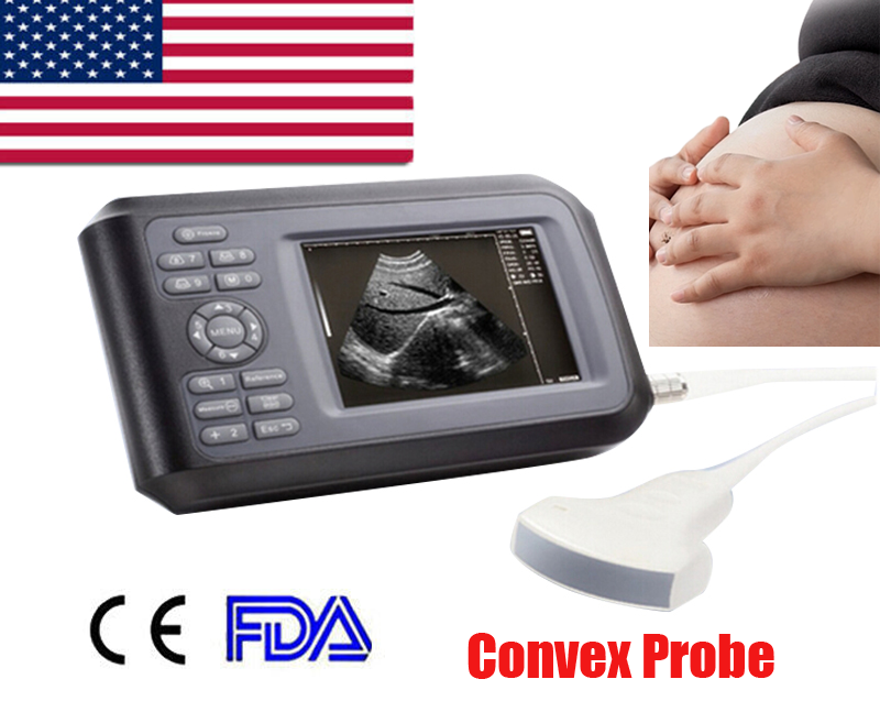 5.5'' Portable Digital Handheld Ultrasound Scanner Laptop Machine+Convex Probe DIAGNOSTIC ULTRASOUND MACHINES FOR SALE