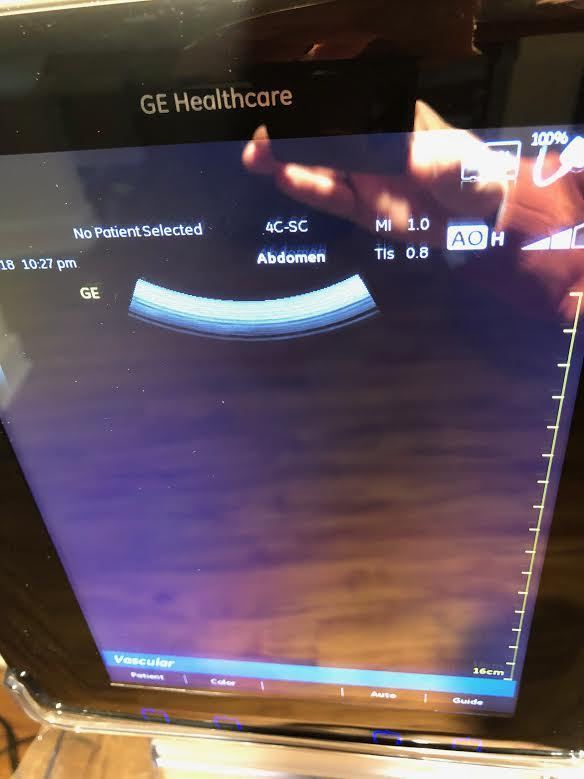 GE Venue 40 Ultrasound Unit with Stand and Two Probes (see description) DIAGNOSTIC ULTRASOUND MACHINES FOR SALE