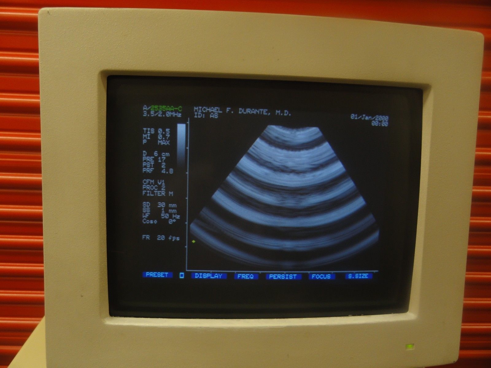 Biosound Esaote AU3 P/N 7050 Ultrasound W/ LA 13 & 2535AA-C Probe& Printer 5818 DIAGNOSTIC ULTRASOUND MACHINES FOR SALE