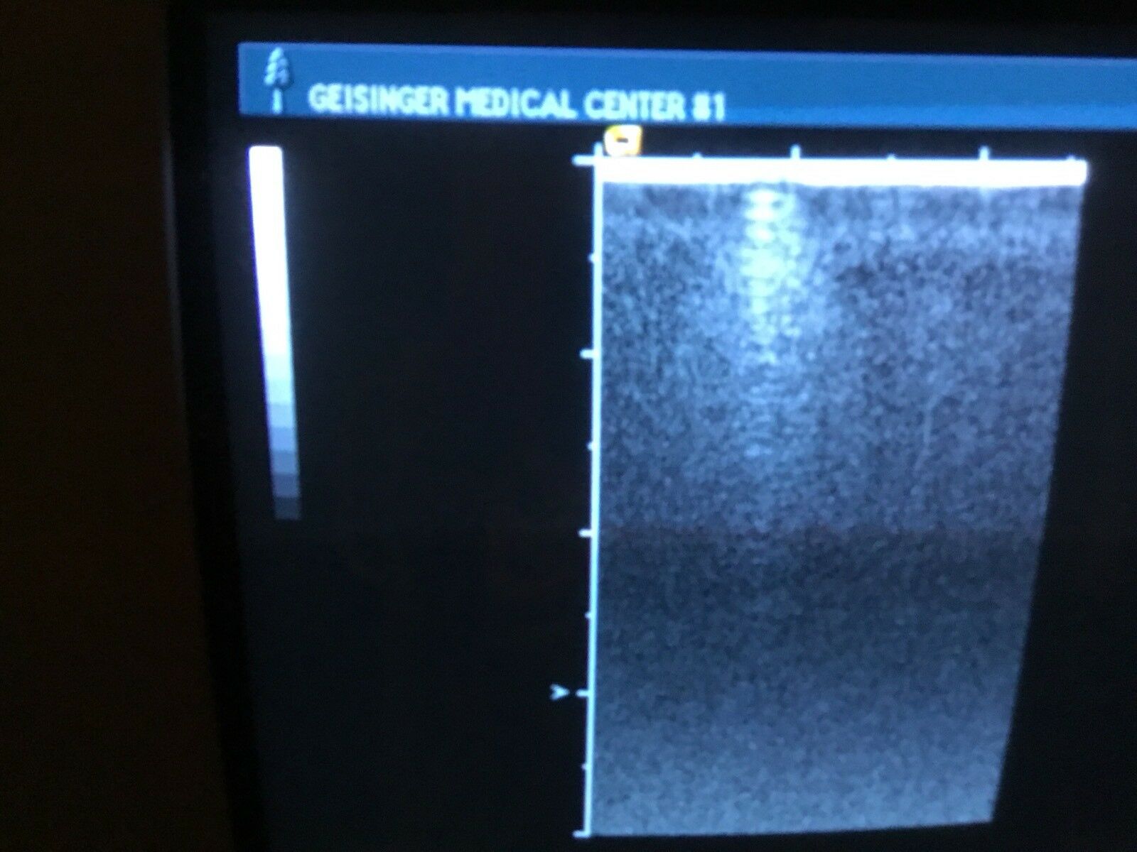 SIEMENS ACUSON 15L8w Ultrasound Transducer Probe DIAGNOSTIC ULTRASOUND MACHINES FOR SALE