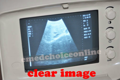 Portable Machine Digital Ultrasound Scanner Transvaginal Probe -Free 3D Software 190891982230 DIAGNOSTIC ULTRASOUND MACHINES FOR SALE