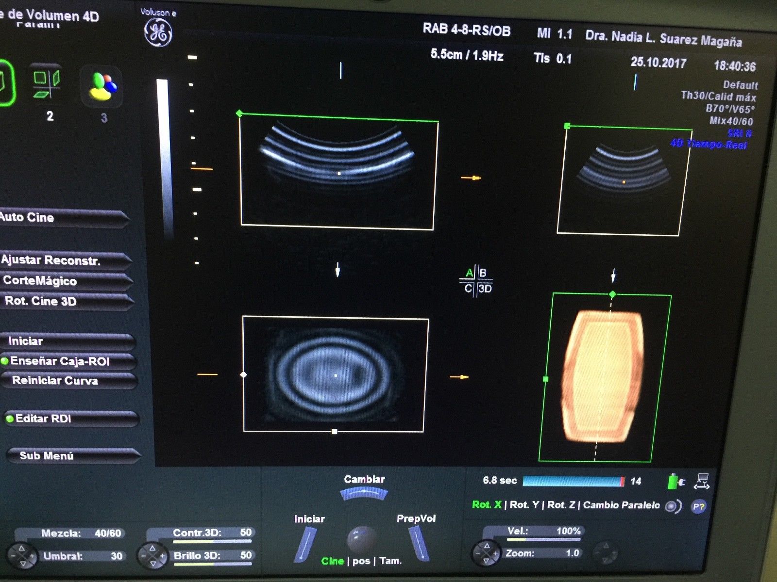 GE RAB4-8-RS 4D CONVEX PROBE FOR VOLUSON i/e/S6/S8 DIAGNOSTIC ULTRASOUND MACHINES FOR SALE