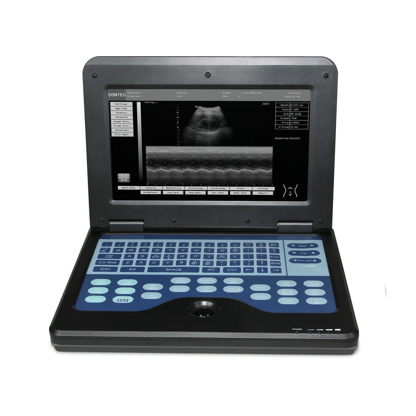 Ultrasound Scanner Laptop Machine with 3 probe-Convex/Linear/Cardiac probe DIAGNOSTIC ULTRASOUND MACHINES FOR SALE