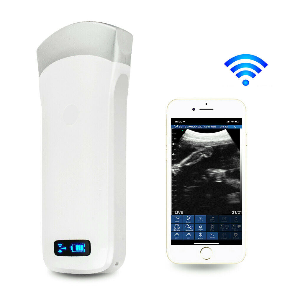 Portable WIFI Wireless Ultrasound Scanner Machine Convex Probe 3.5Mhz Medical CE DIAGNOSTIC ULTRASOUND MACHINES FOR SALE