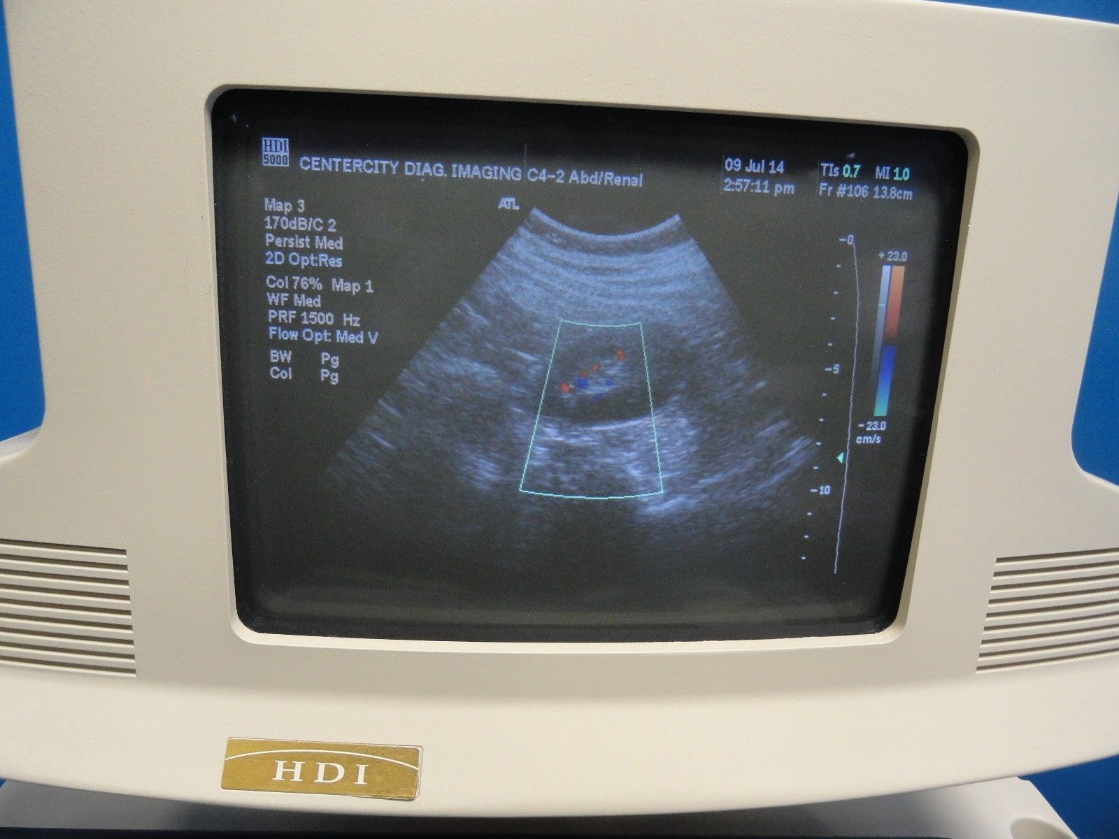 ATL AT3C42B / C4-2 Curved Array Broadband Probe (Abdominal OB/GYN General )6853 DIAGNOSTIC ULTRASOUND MACHINES FOR SALE