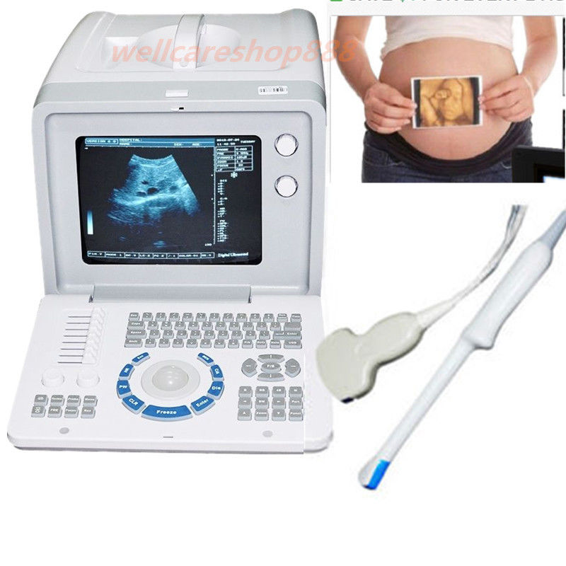 Full Digital Ultrasound Scanner System convex Transvaginal Sensor Probe+3D CE 190891814074 DIAGNOSTIC ULTRASOUND MACHINES FOR SALE