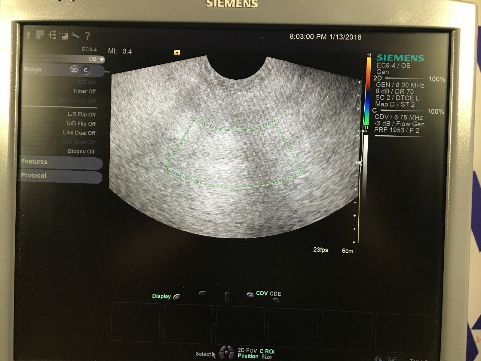 SIEMENS ACUSON S2000 Ultrasound MFG 05/2013 w/ 6C2, 4V1 and EC9-4 Probe DIAGNOSTIC ULTRASOUND MACHINES FOR SALE