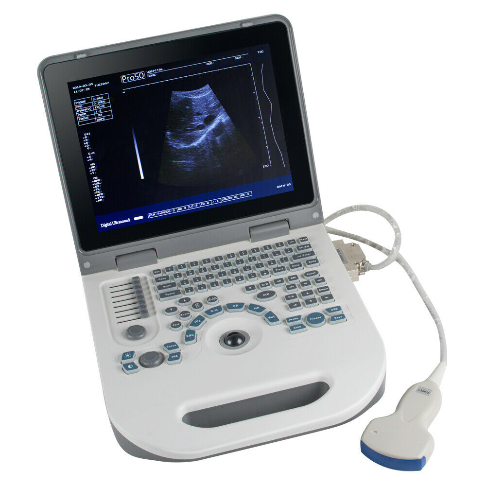 Portable Digital Ultrasound Scanner machine Abdomen Baby Convex Probe + 3D Pack DIAGNOSTIC ULTRASOUND MACHINES FOR SALE