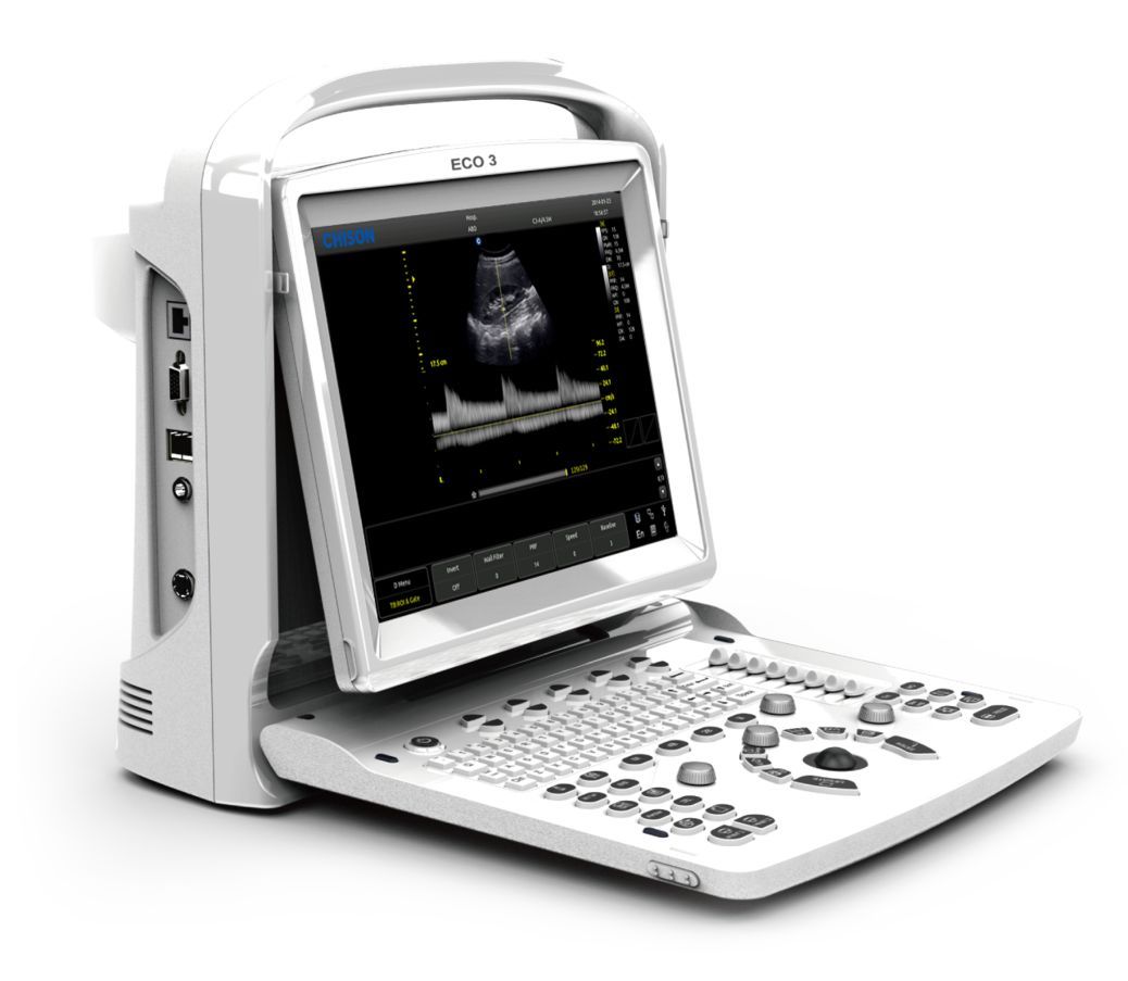 Best Deal Ultrasound Chison ECO3, Amazing Quality & Linear Array Probe, Trolley DIAGNOSTIC ULTRASOUND MACHINES FOR SALE