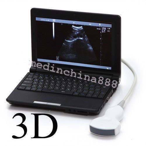 Newest Laptop Ultrasound Scanner +Convex+Linear+Transvaginal 3 Probes +Free Box DIAGNOSTIC ULTRASOUND MACHINES FOR SALE