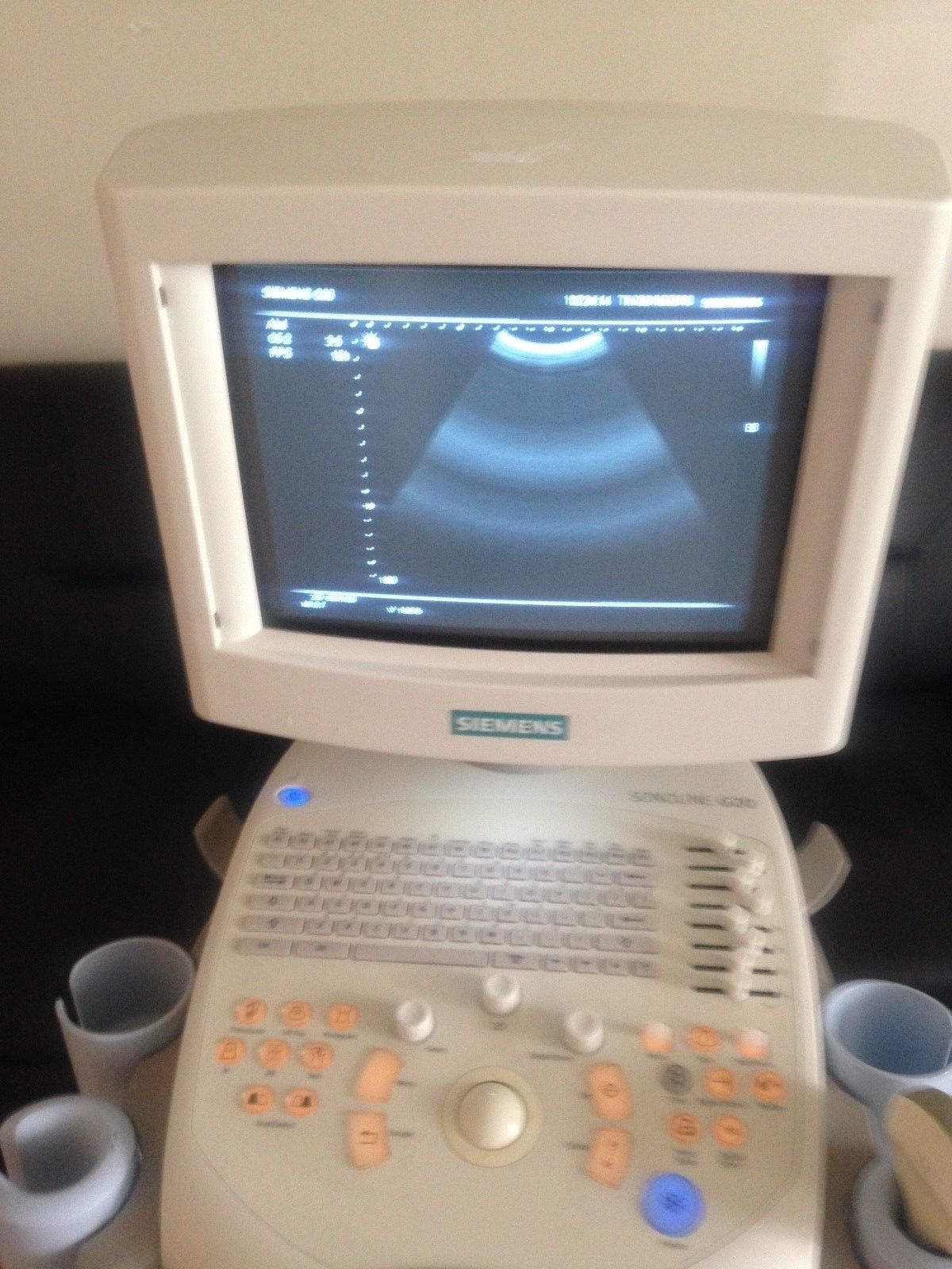 Siemens SONOLINE G20 Ultrasound System DIAGNOSTIC ULTRASOUND MACHINES FOR SALE