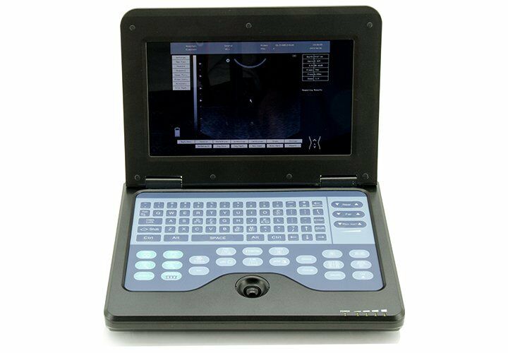 Portable Laptop Digital Ultrasound Scanner High Resolution,Convex/abdominal Prob DIAGNOSTIC ULTRASOUND MACHINES FOR SALE