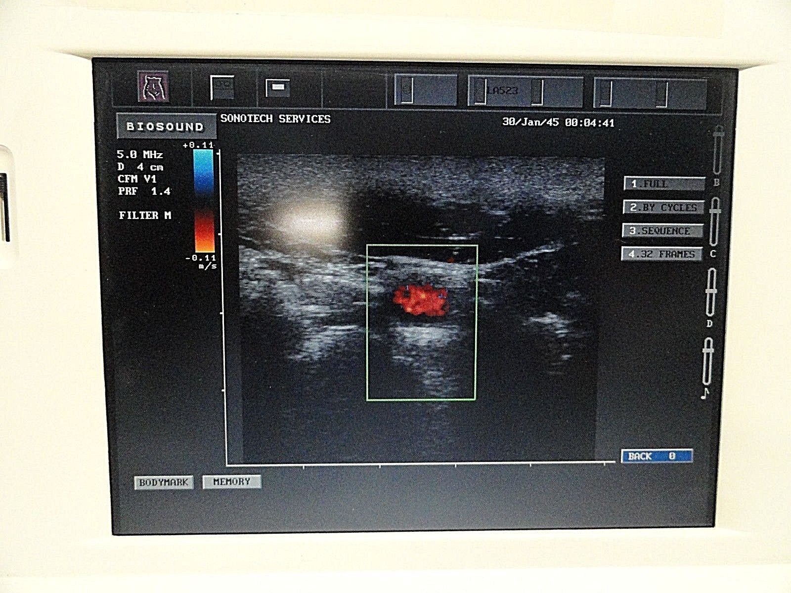 Biosound ESAOTE LA523 10-5 MHz Linear Array Ultrasound Transducer ~ 14901 DIAGNOSTIC ULTRASOUND MACHINES FOR SALE