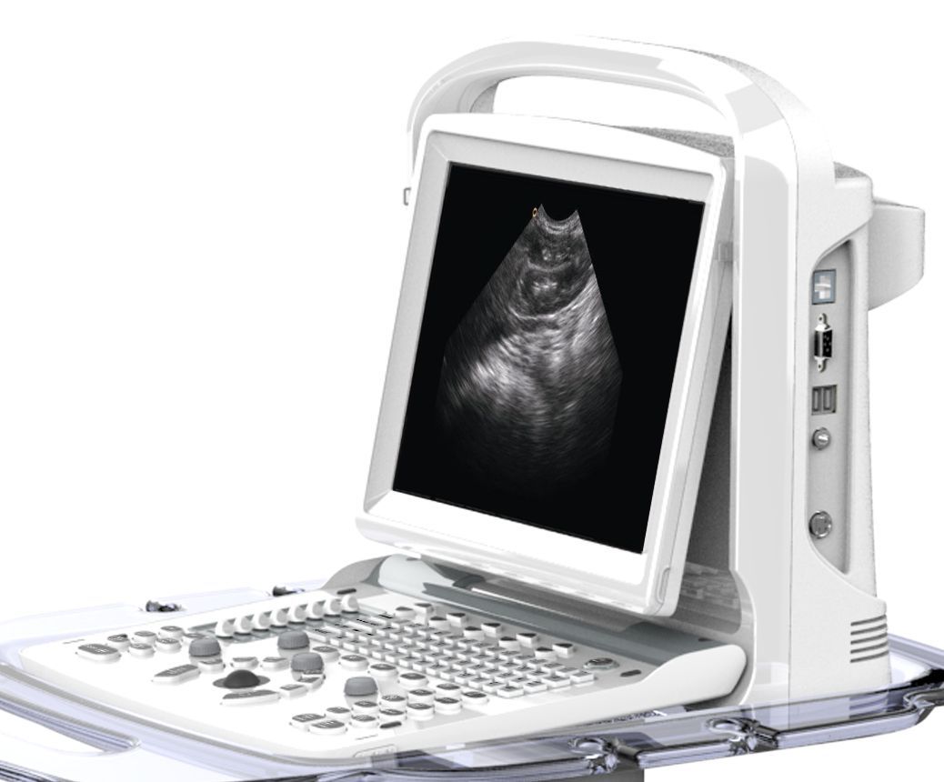 Chison ECO3, MSK, Tendon, Vascular Black/White Ultrasound Machine & Linear Probe DIAGNOSTIC ULTRASOUND MACHINES FOR SALE