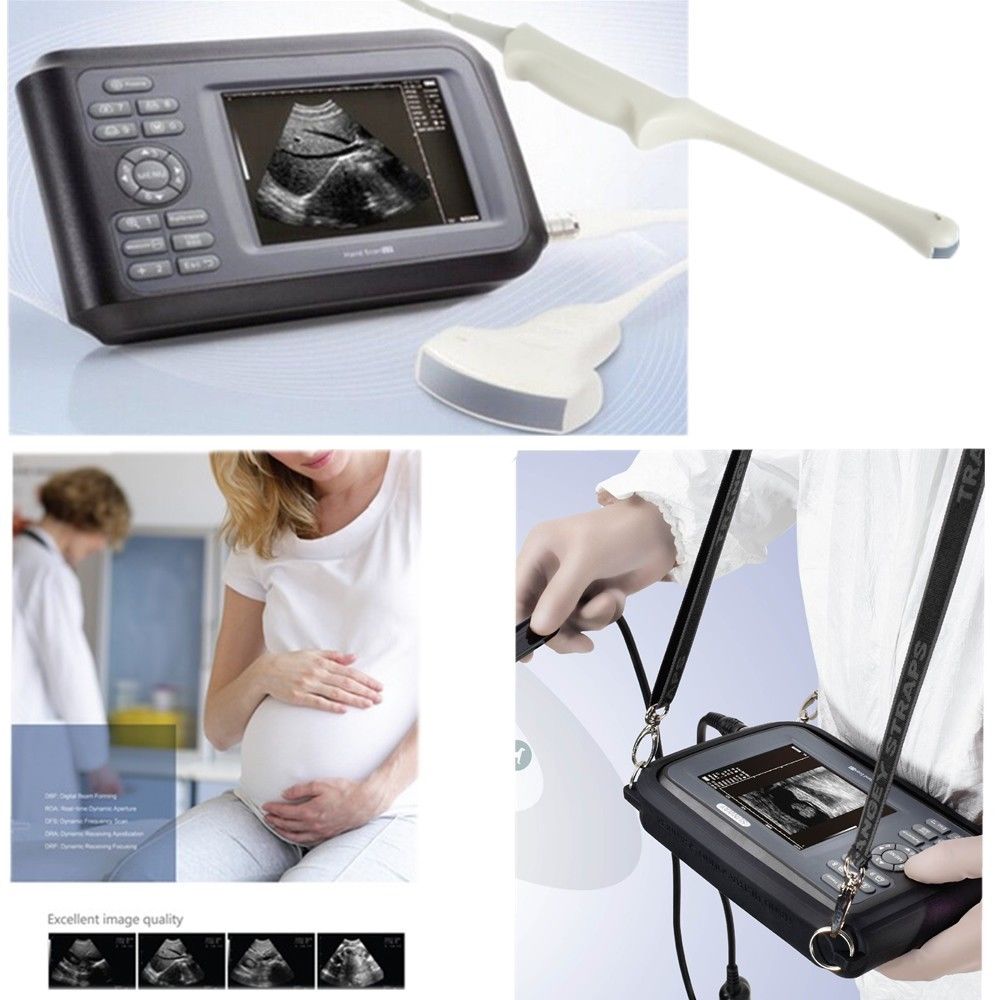 Laptop Machine HandScan Ultrasound scanner Convex + Transvaginal Probe + Case 190891593870 DIAGNOSTIC ULTRASOUND MACHINES FOR SALE