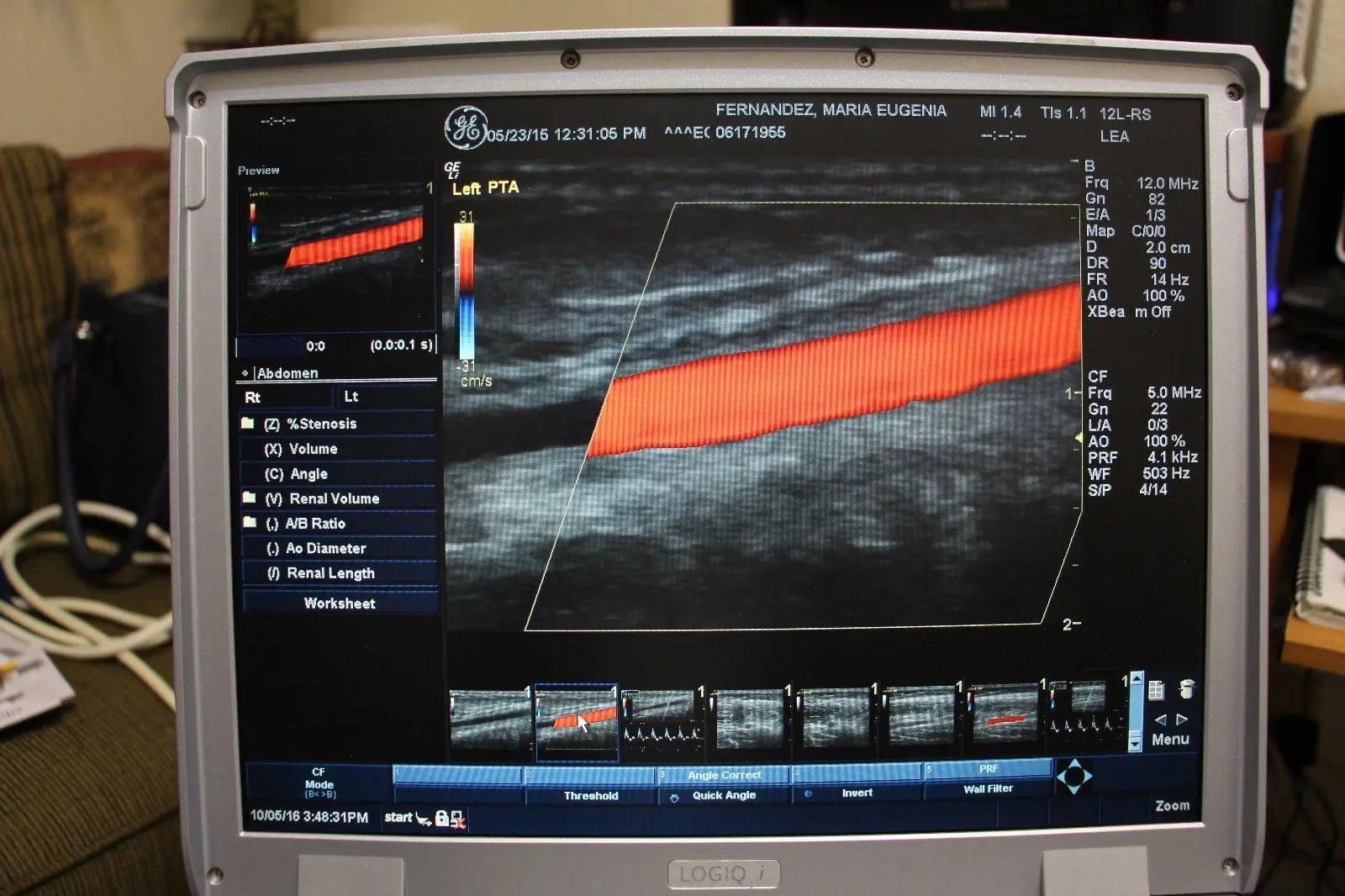 Portable Ultrasound Machine GE LOGIQ i 2007 with 2 Transducers DIAGNOSTIC ULTRASOUND MACHINES FOR SALE