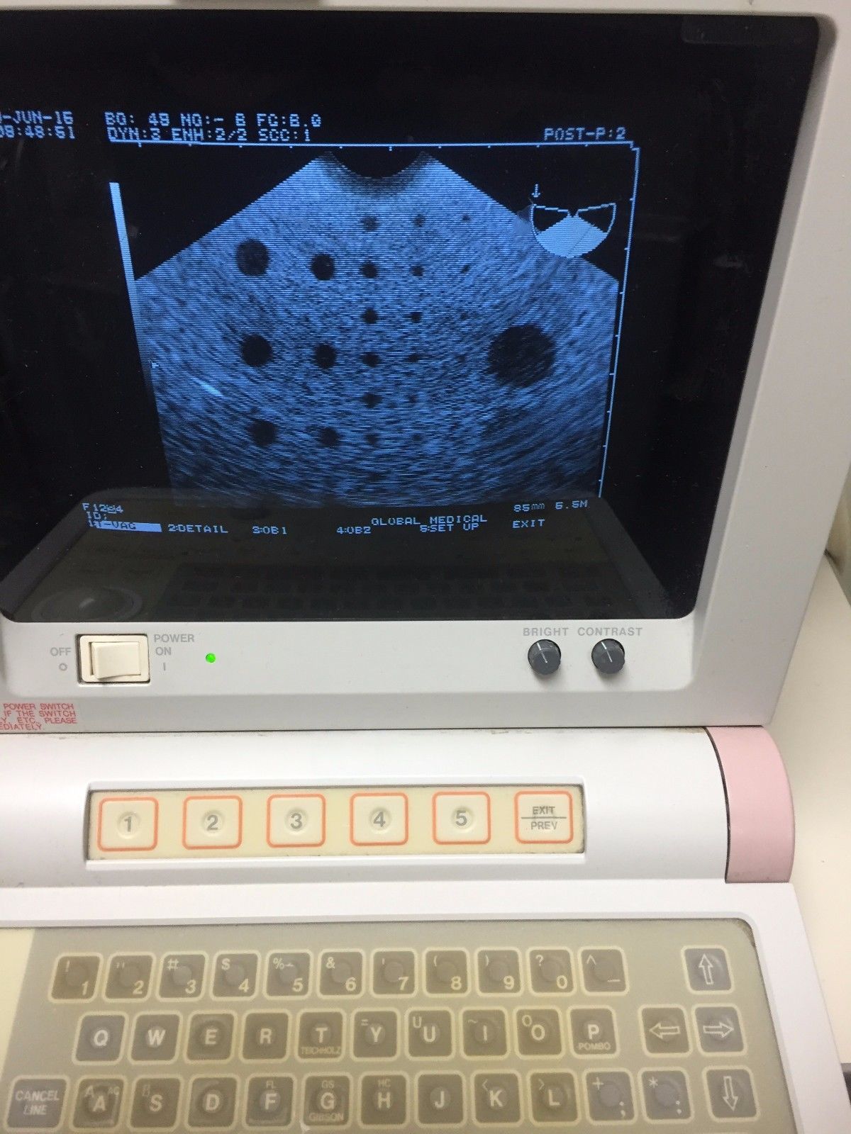 Hitachi EUB-405 Plus Ultrasound / 2 probes / 2 transducer port / printer DIAGNOSTIC ULTRASOUND MACHINES FOR SALE