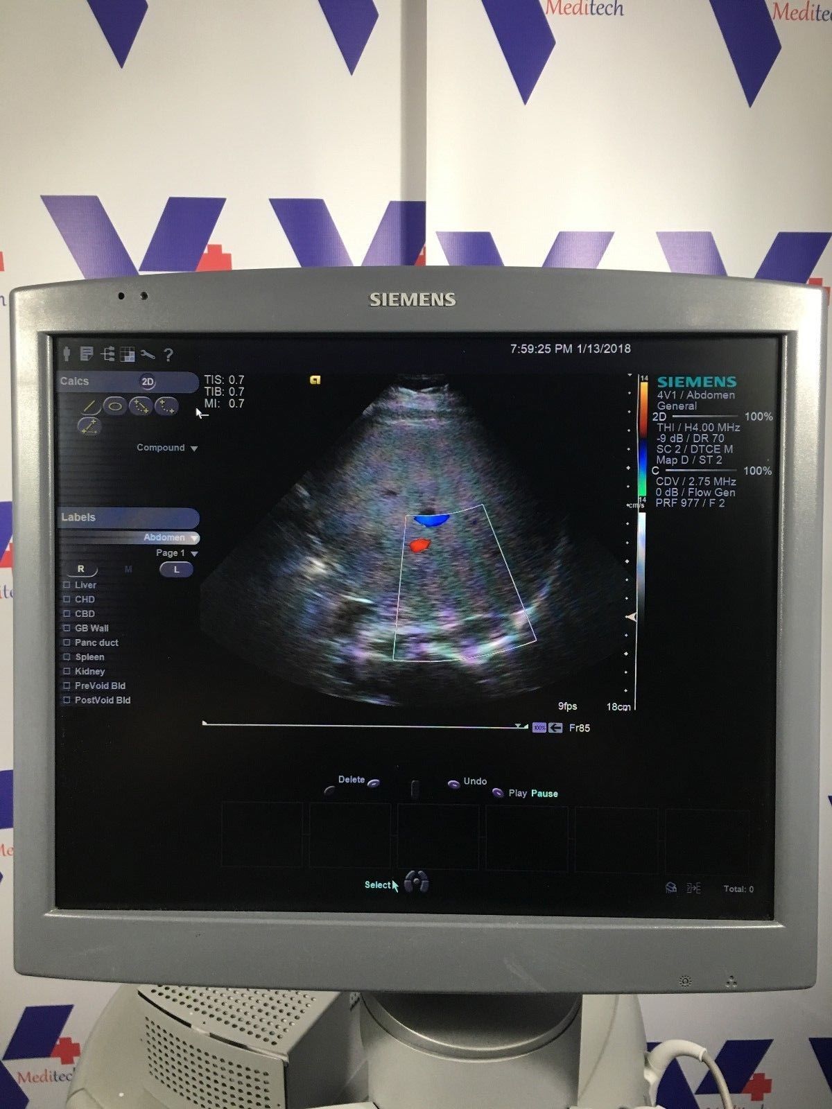 SIEMENS ACUSON S2000 Ultrasound MFG 05/2013 w/ 6C2, 4V1 and EC9-4 Probe DIAGNOSTIC ULTRASOUND MACHINES FOR SALE