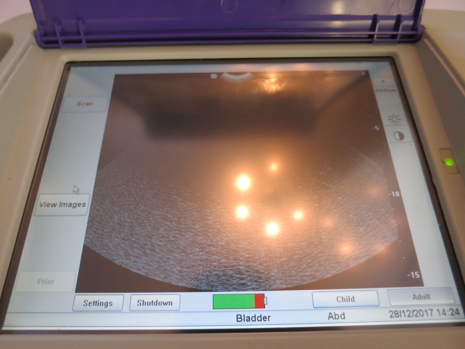 PORTASCAN+ PORTABLE TOUCHSCREEN ULTRASOUND BARD BLADDER SCANNER UROLOGY IMAGING DIAGNOSTIC ULTRASOUND MACHINES FOR SALE