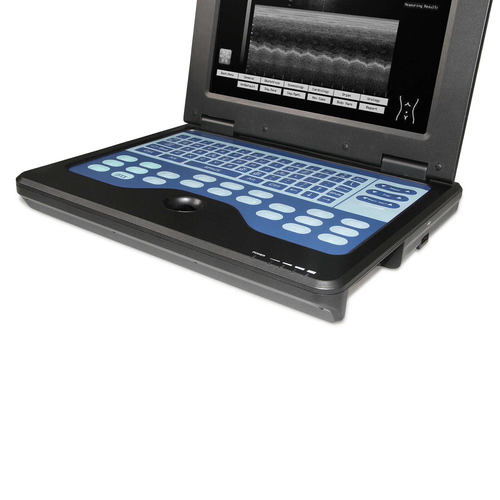 USA Digital Portable laptop machine Digital Ultrasound scanner+3.5 Convex probe DIAGNOSTIC ULTRASOUND MACHINES FOR SALE