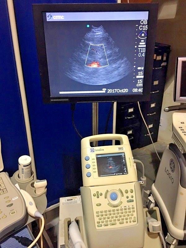 Sonosite 180 Plus ultrasound with docking unit aux. monitor and 2 Probes DIAGNOSTIC ULTRASOUND MACHINES FOR SALE