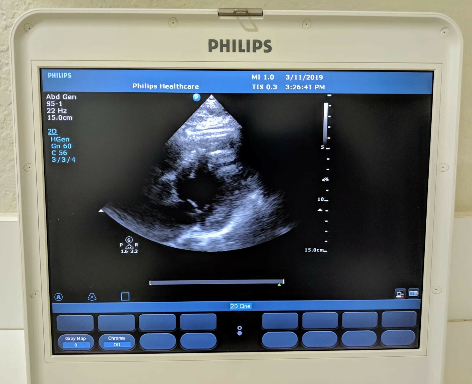 PHILIPS CX50 2013 REV 4 W/ 3 PROBES PORTABLE ULTRASOUND DIAGNOSTIC ULTRASOUND MACHINES FOR SALE