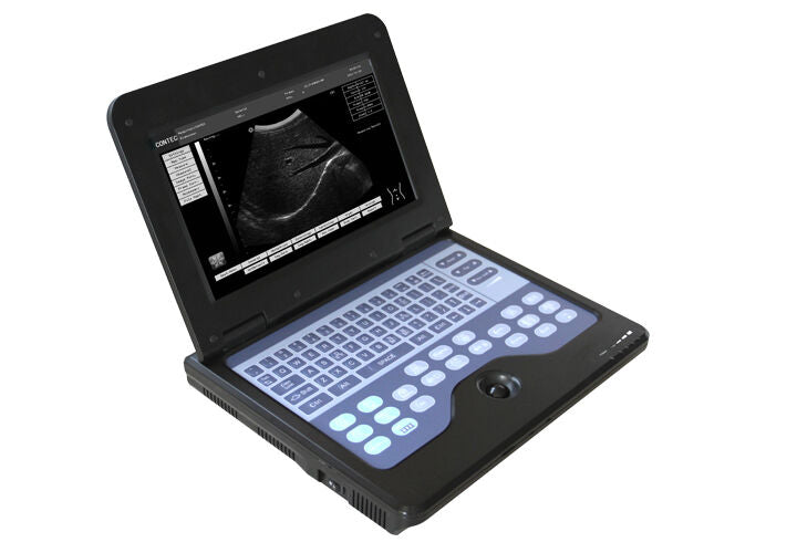 Basic Laptop Medical Ultrasound Scanner + 3 Probes Linear/ Convex/ Transvaginal DIAGNOSTIC ULTRASOUND MACHINES FOR SALE