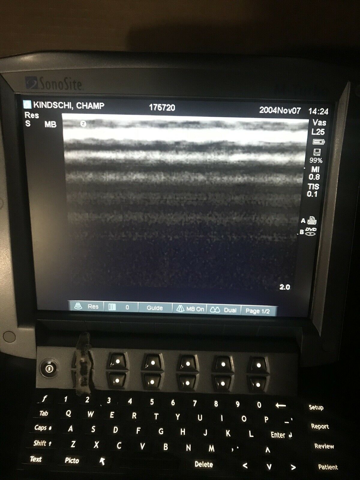 SonoSite M-Turbo Ultrasound System and L2S transducers DIAGNOSTIC ULTRASOUND MACHINES FOR SALE