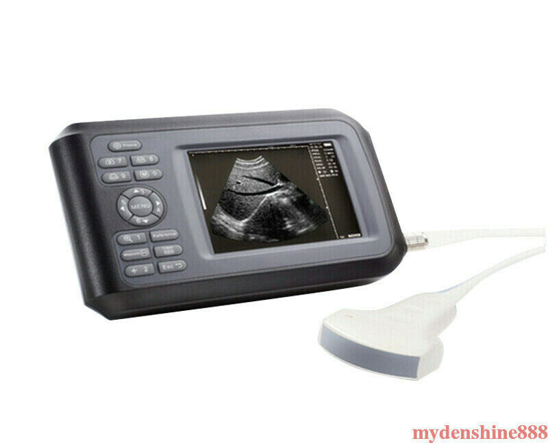 Portable Handheld Human Ultrasound Scanner Machine + 3.5mhz Convex Probe + Case DIAGNOSTIC ULTRASOUND MACHINES FOR SALE