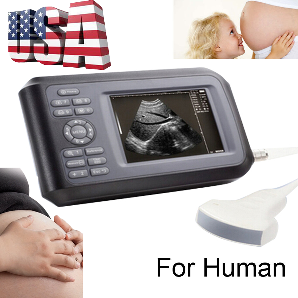 Handheld Ultrasound Scanner/Machine Convex Probe Abdominal Ultrasound Human Use DIAGNOSTIC ULTRASOUND MACHINES FOR SALE