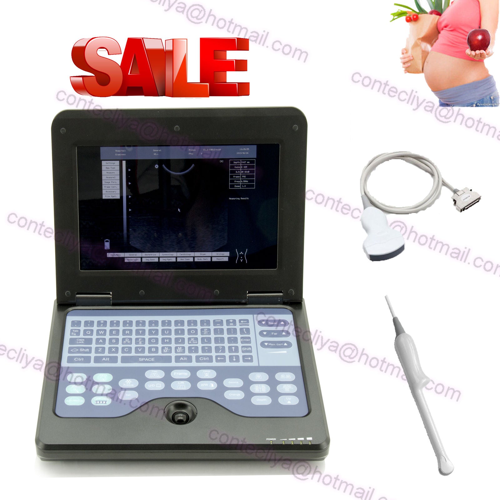 CE Digital Ultrasound Scanner Laptop Machine Diagnostic System Optional 4 Probe DIAGNOSTIC ULTRASOUND MACHINES FOR SALE