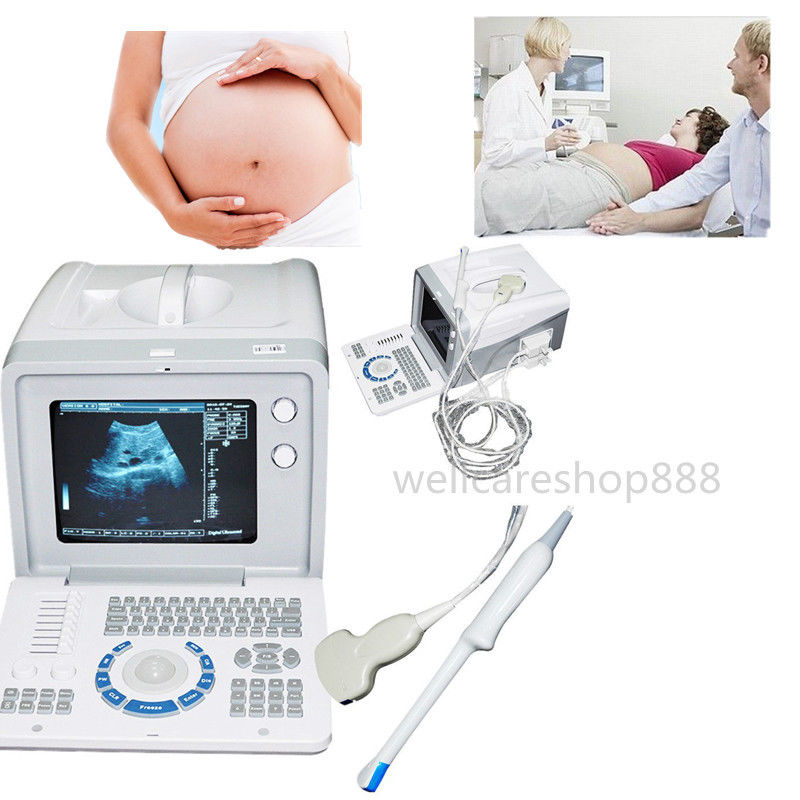 Top 3D Digital Ultrasound Scanner Machine Convex +Transvaginal Probe Pregnancy DIAGNOSTIC ULTRASOUND MACHINES FOR SALE