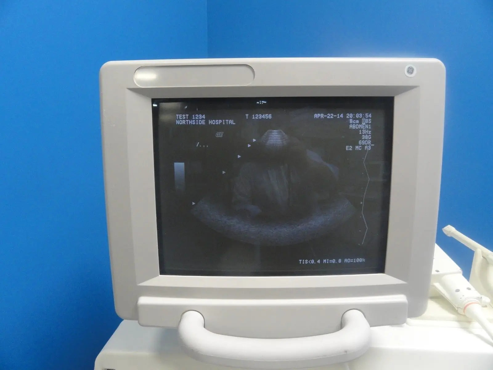 2001 GE 8S P/N 2266327 Cardiac Sector Ultrasound Transducer W/ Hook (6693) DIAGNOSTIC ULTRASOUND MACHINES FOR SALE