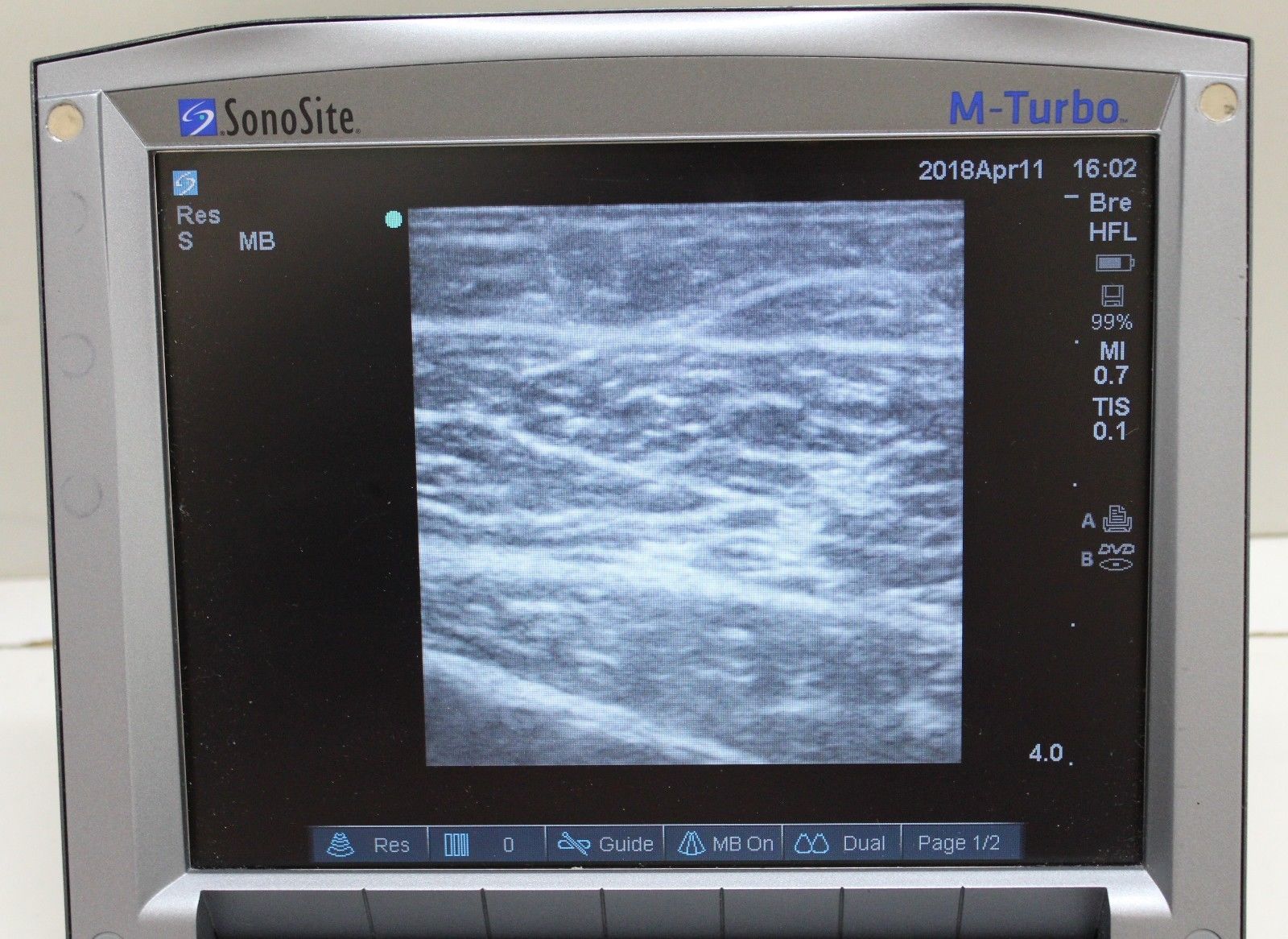 Sonosite M-Turbo Ultrasound with HFL38x Linear Probe ( serviced April 2018) DIAGNOSTIC ULTRASOUND MACHINES FOR SALE