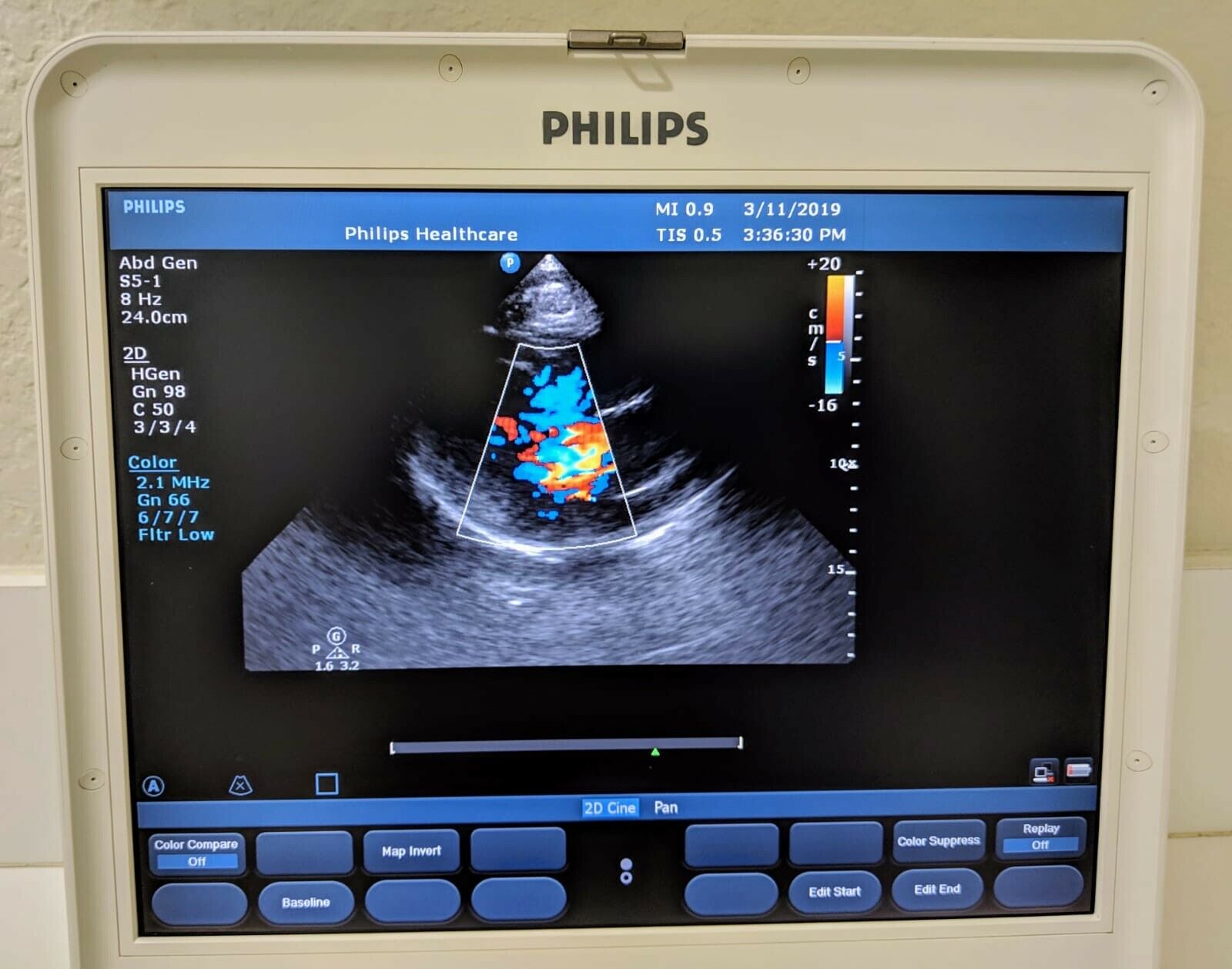 PHILIPS CX50 2013 REV 4 W/ 3 PROBES PORTABLE ULTRASOUND DIAGNOSTIC ULTRASOUND MACHINES FOR SALE