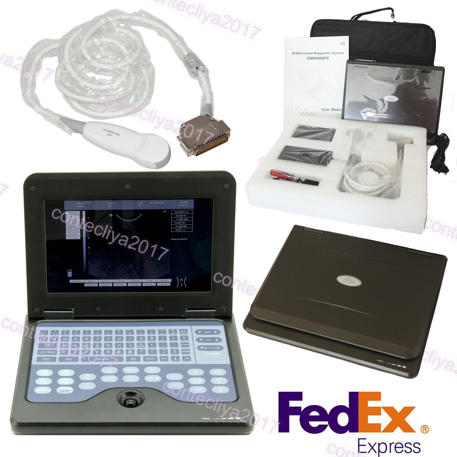 USA,Portable Ultrasound Scanner Laptop Machine Convex/Linear/Cardiac/Tranvaginal DIAGNOSTIC ULTRASOUND MACHINES FOR SALE