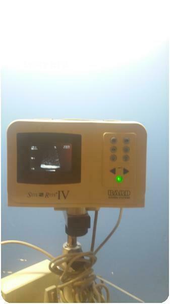 BARD ACCESS SYSTEMS SITE RITE IV VASCULAR ULTRASOUND SYSTEM % (261780) DIAGNOSTIC ULTRASOUND MACHINES FOR SALE