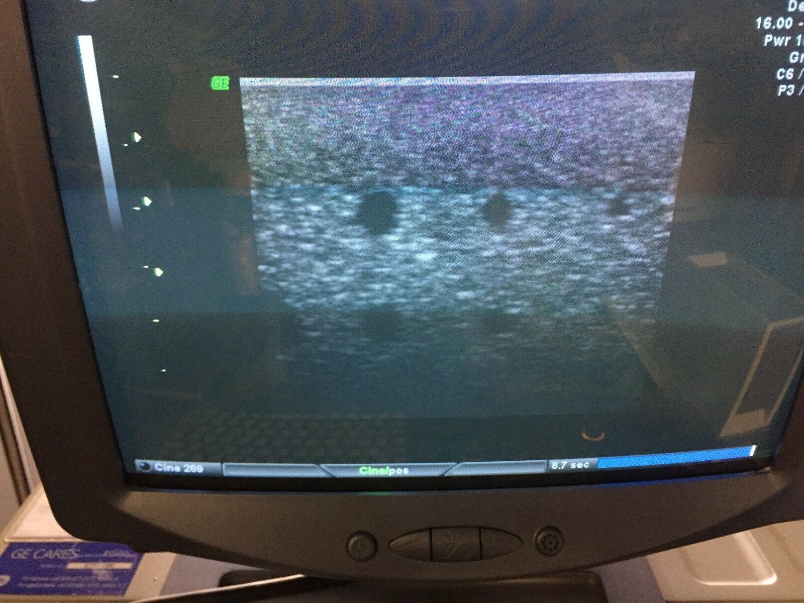 GE SP10-16 Ultrasound Probe/Transducer DIAGNOSTIC ULTRASOUND MACHINES FOR SALE