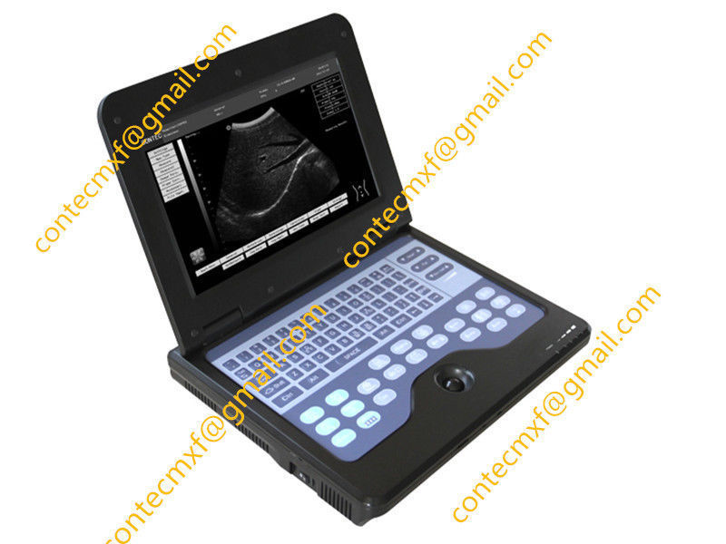 CE Portable Ultrasound Scanner Laptop Machine Diagnostic System Optional 4 Probe DIAGNOSTIC ULTRASOUND MACHINES FOR SALE