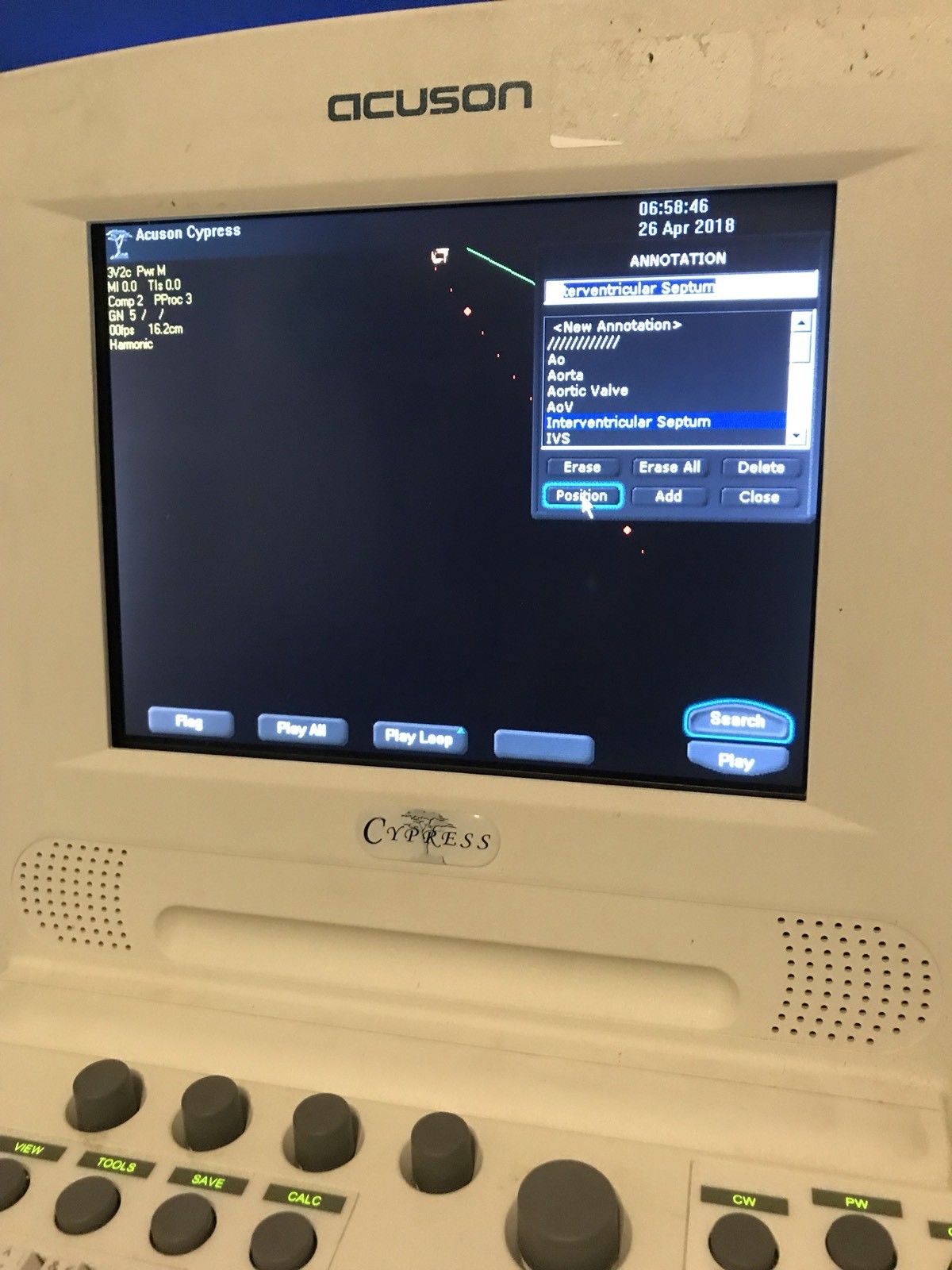 SIEMENS  Acuson Cypress Ultrasound Machine DIAGNOSTIC ULTRASOUND MACHINES FOR SALE