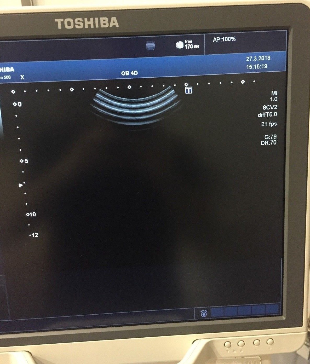 Toshiba PVT-675MV Ultrasound Transducer DIAGNOSTIC ULTRASOUND MACHINES FOR SALE