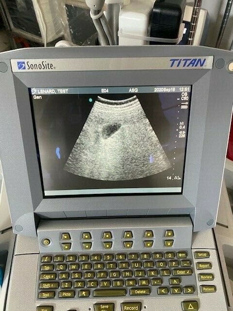 2008 Sonosite Titan Ultrasound system with Docking cart 19" Monitor DIAGNOSTIC ULTRASOUND MACHINES FOR SALE