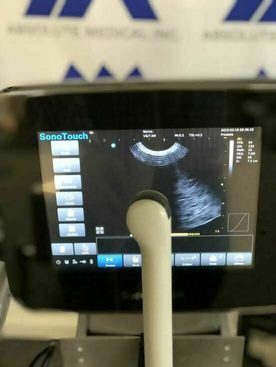 Chison Sonotouch 30 Touch Screen Portable Ultrasound Machine with Three Probes! DIAGNOSTIC ULTRASOUND MACHINES FOR SALE