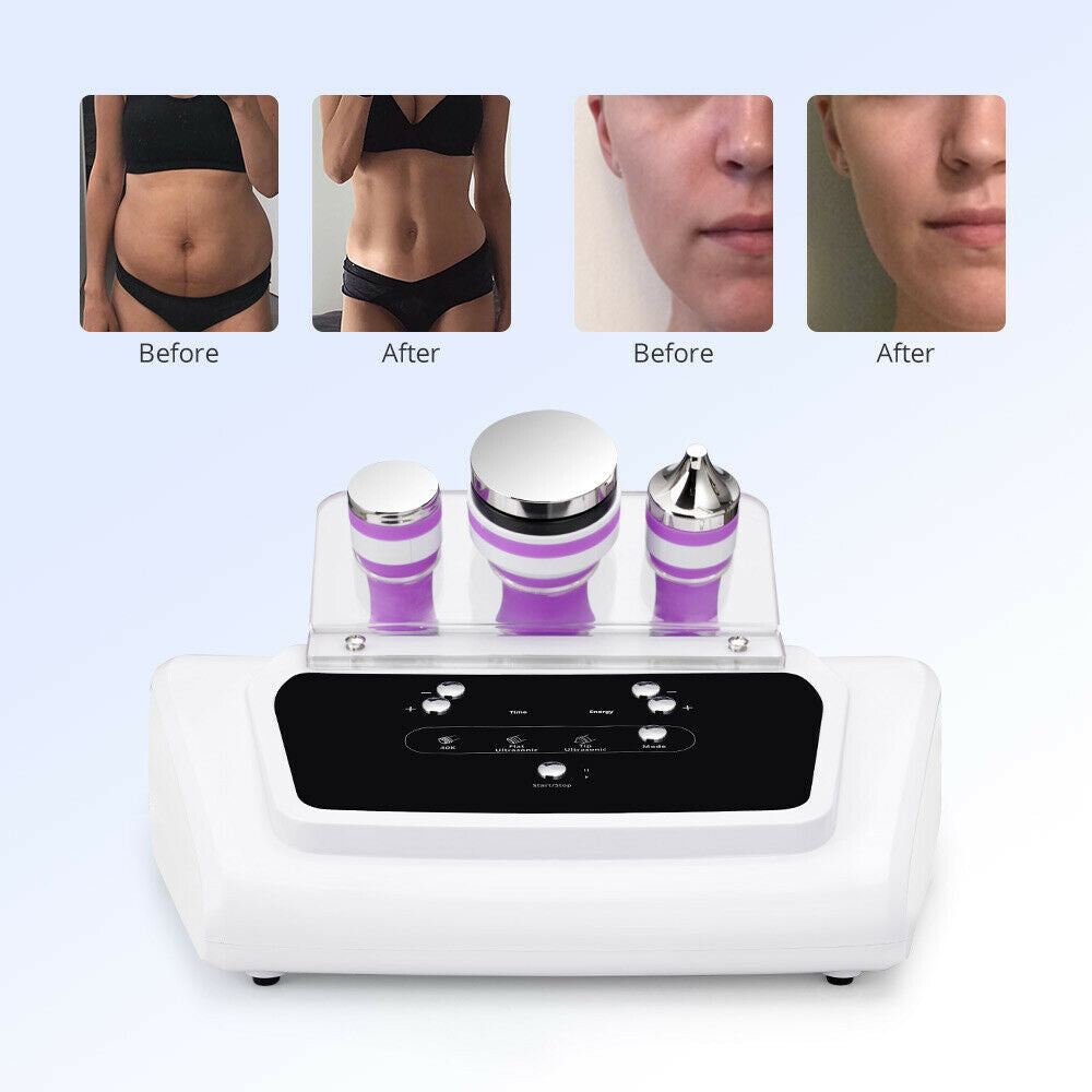 3IN1 Ultrasound Cavitation Body Slimming Massage Skin Care Ultrasonic Machine US 751940677295 DIAGNOSTIC ULTRASOUND MACHINES FOR SALE